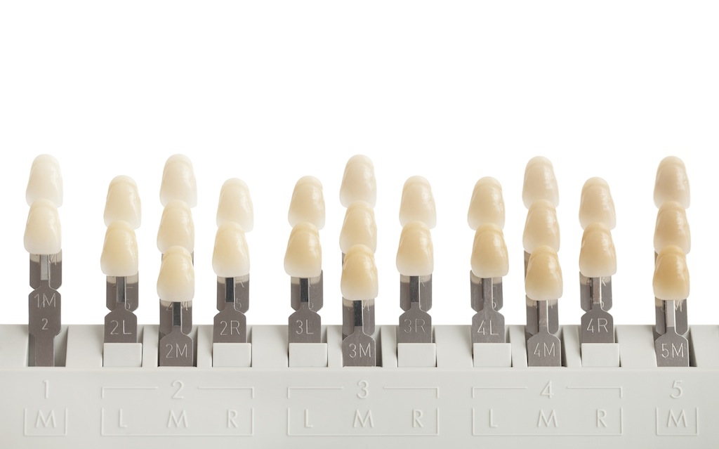 Image shows a shade guide: a device that will help Nik Lutz to determine the colours in your teeth